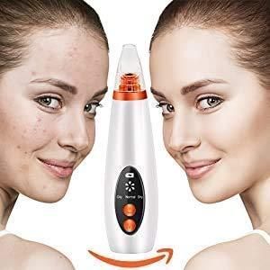 β¨ Electric Blackhead Remover πββοΈ | USB