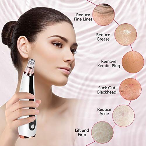 β¨ Electric Blackhead Remover πββοΈ | USB